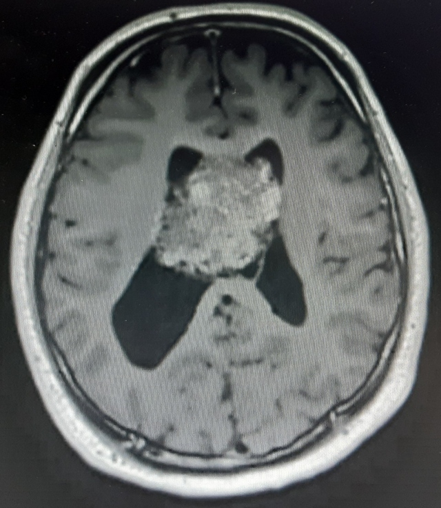 Featured image for How it all started